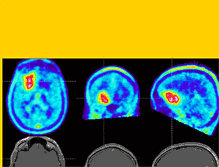 Tablet Screenshot of hirntumor.net